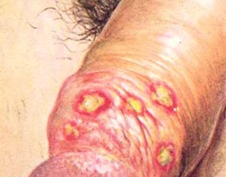 ��������� �������