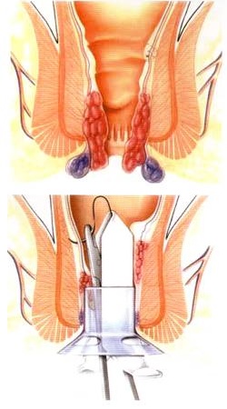 ���������������� � ������������� �������� ����� ��������